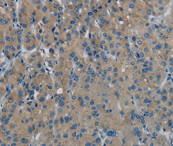 PHKG1 Antibody in Immunohistochemistry (Paraffin) (IHC (P))