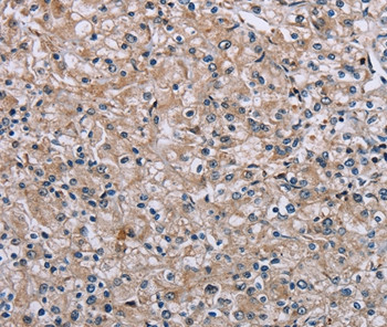 PLCL1 Antibody in Immunohistochemistry (Paraffin) (IHC (P))