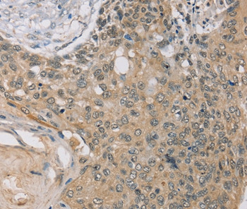 RASA2 Antibody in Immunohistochemistry (Paraffin) (IHC (P))