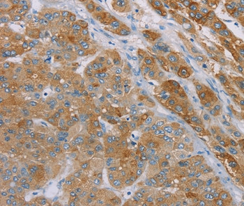 SAMD4A Antibody in Immunohistochemistry (Paraffin) (IHC (P))