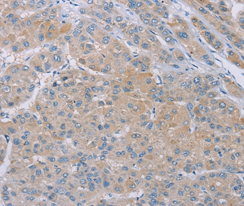 SAMD4B Antibody in Immunohistochemistry (Paraffin) (IHC (P))