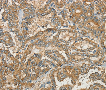 CWC27 Antibody in Immunohistochemistry (Paraffin) (IHC (P))