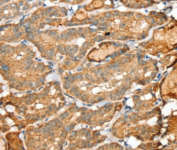 SIGLEC14 Antibody in Immunohistochemistry (Paraffin) (IHC (P))