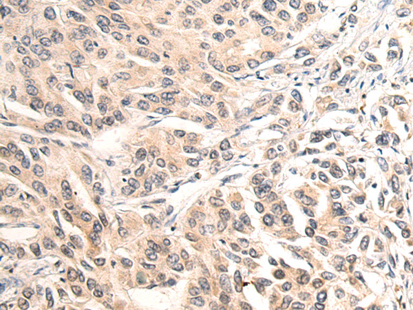 SIGLEC15 Antibody in Immunohistochemistry (Paraffin) (IHC (P))