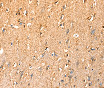 SLC25A3 Antibody in Immunohistochemistry (Paraffin) (IHC (P))