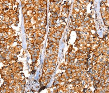 SLC25A3 Antibody in Immunohistochemistry (Paraffin) (IHC (P))