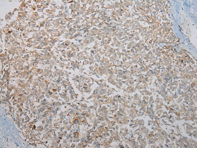 KCNH6 Antibody in Immunohistochemistry (Paraffin) (IHC (P))