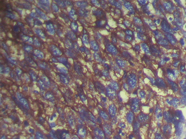 S100A14 Antibody in Immunohistochemistry (Paraffin) (IHC (P))