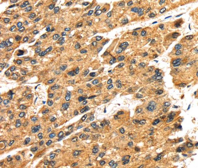 SLC25A26 Antibody in Immunohistochemistry (Paraffin) (IHC (P))