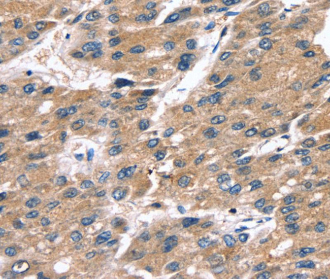 Serglycin Antibody in Immunohistochemistry (Paraffin) (IHC (P))