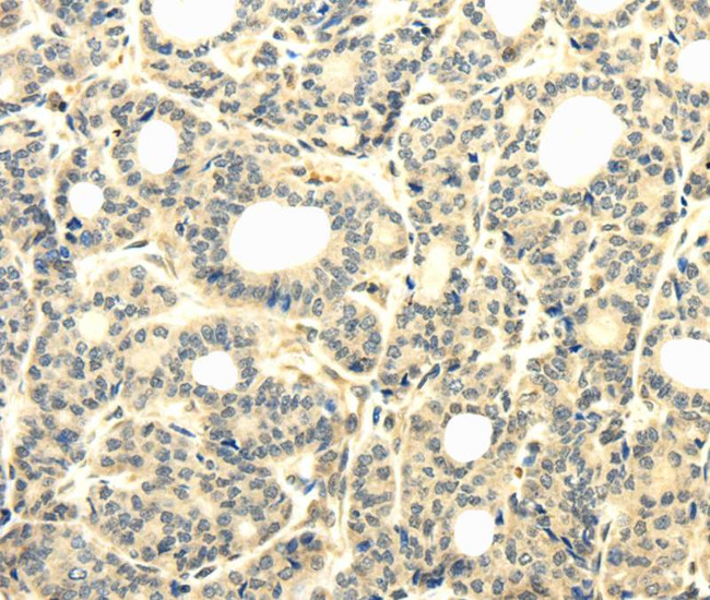 TBC1D22A Antibody in Immunohistochemistry (Paraffin) (IHC (P))