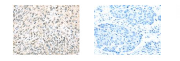 TCEB1 Antibody in Immunohistochemistry (Paraffin) (IHC (P))