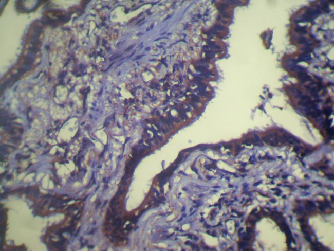 TCEB1 Antibody in Immunohistochemistry (Paraffin) (IHC (P))