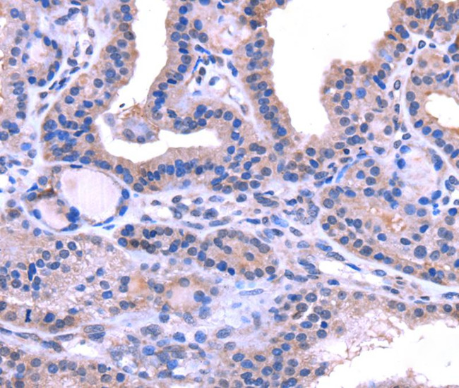 TRIM14 Antibody in Immunohistochemistry (Paraffin) (IHC (P))