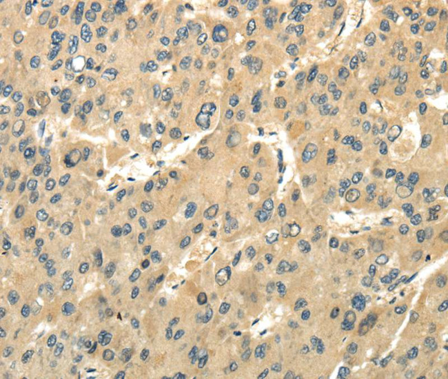 UBAP1 Antibody in Immunohistochemistry (Paraffin) (IHC (P))