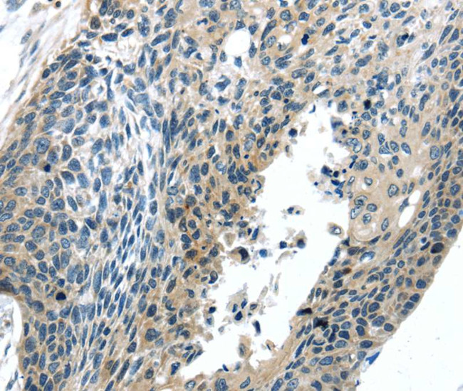 BOK Antibody in Immunohistochemistry (Paraffin) (IHC (P))