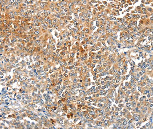 MAGEB2 Antibody in Immunohistochemistry (Paraffin) (IHC (P))