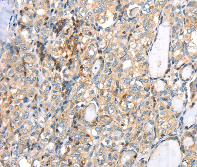 MAGEB2 Antibody in Immunohistochemistry (Paraffin) (IHC (P))