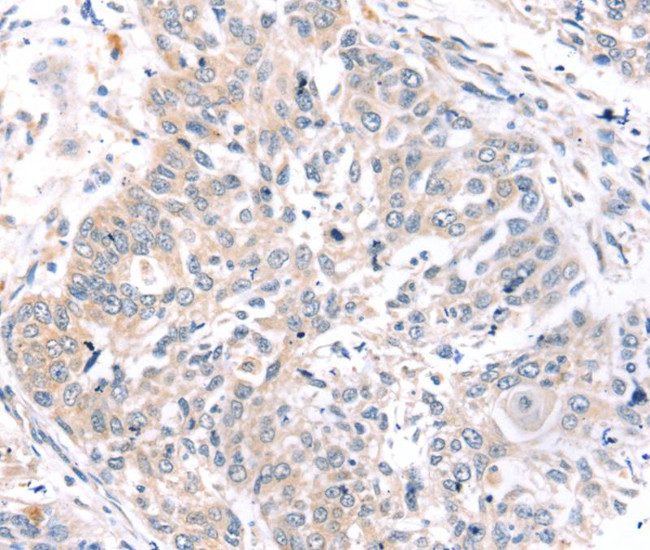 ROR1 Antibody in Immunohistochemistry (Paraffin) (IHC (P))