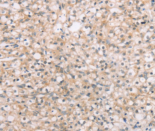 ROR1 Antibody in Immunohistochemistry (Paraffin) (IHC (P))