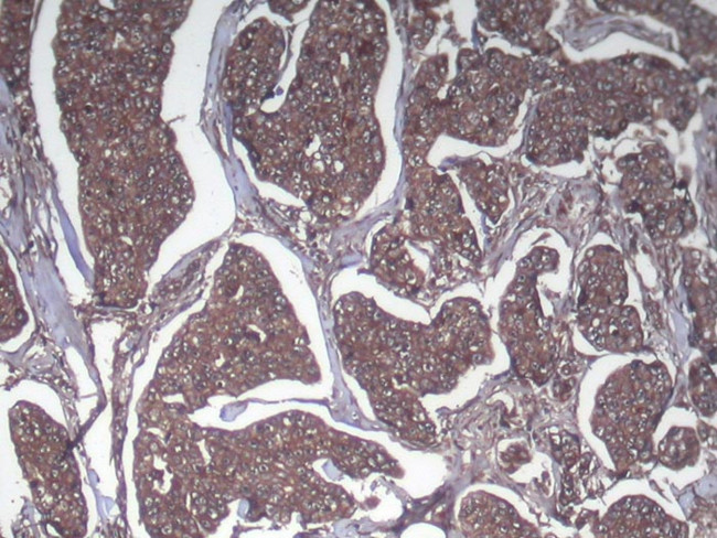 SRGAP1 Antibody in Immunohistochemistry (Paraffin) (IHC (P))