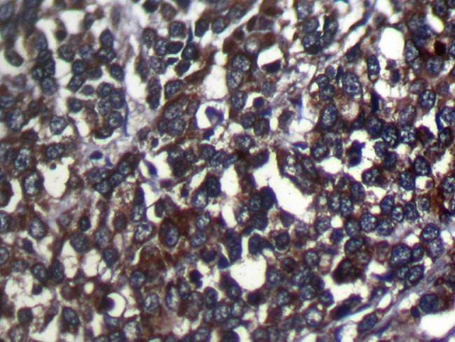 SRGAP1 Antibody in Immunohistochemistry (Paraffin) (IHC (P))