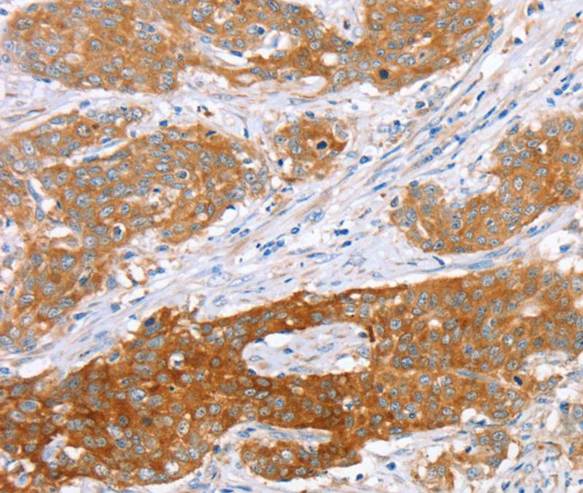 SUR1 Antibody in Immunohistochemistry (Paraffin) (IHC (P))