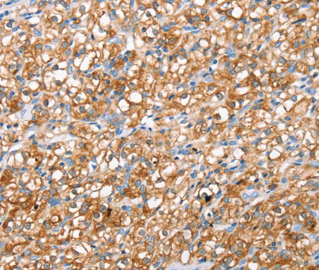 SUR1 Antibody in Immunohistochemistry (Paraffin) (IHC (P))