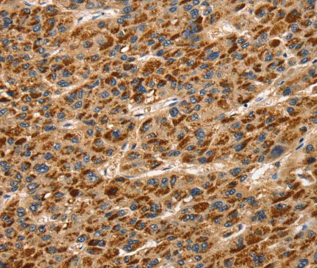 Talin 1 Antibody in Immunohistochemistry (Paraffin) (IHC (P))