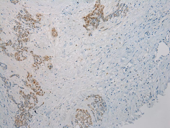 Thrombospondin 2 Antibody in Immunohistochemistry (Paraffin) (IHC (P))