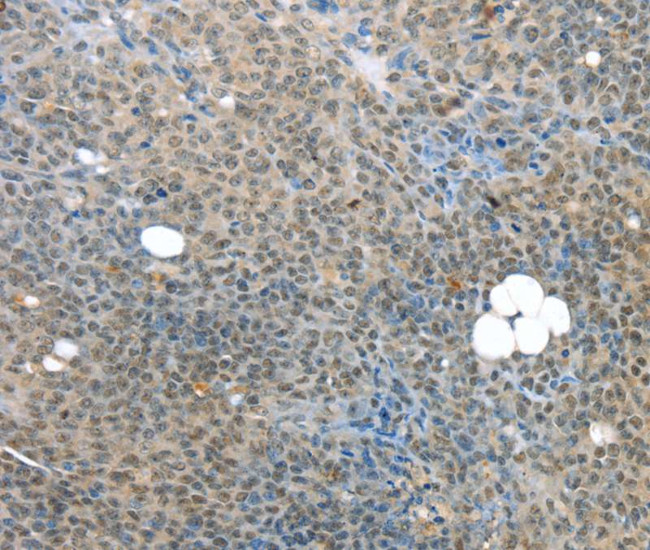 PCQAP Antibody in Immunohistochemistry (Paraffin) (IHC (P))