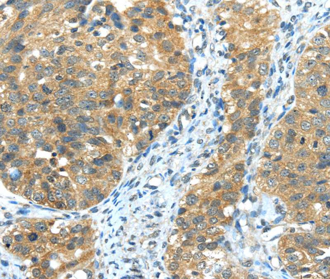 TRIB1 Antibody in Immunohistochemistry (Paraffin) (IHC (P))