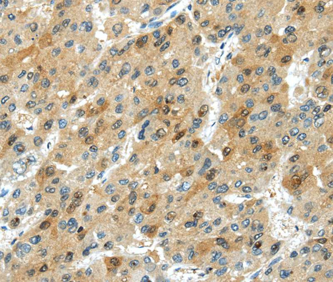 TRIB1 Antibody in Immunohistochemistry (Paraffin) (IHC (P))