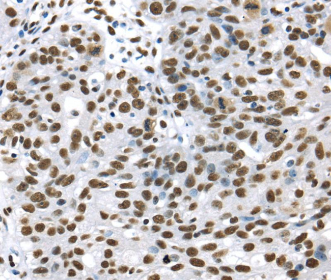 UAP56 Antibody in Immunohistochemistry (Paraffin) (IHC (P))