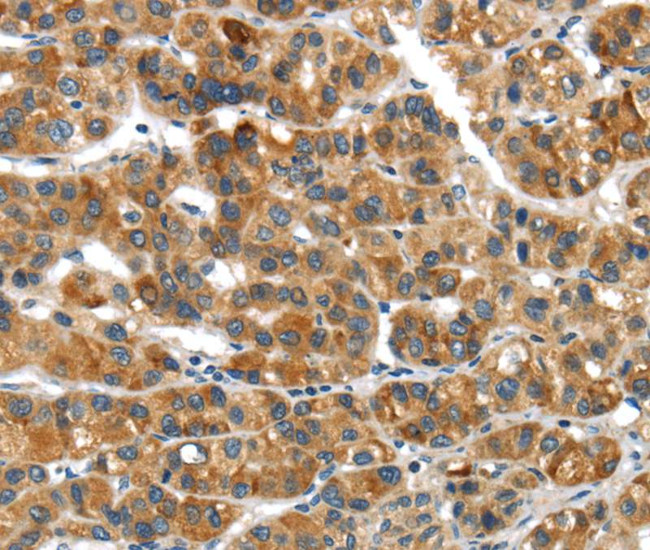 UBAP2 Antibody in Immunohistochemistry (Paraffin) (IHC (P))