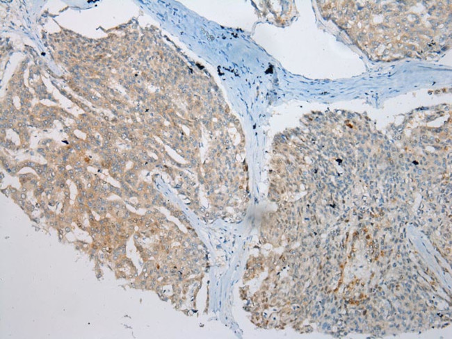 VPS4A Antibody in Immunohistochemistry (Paraffin) (IHC (P))