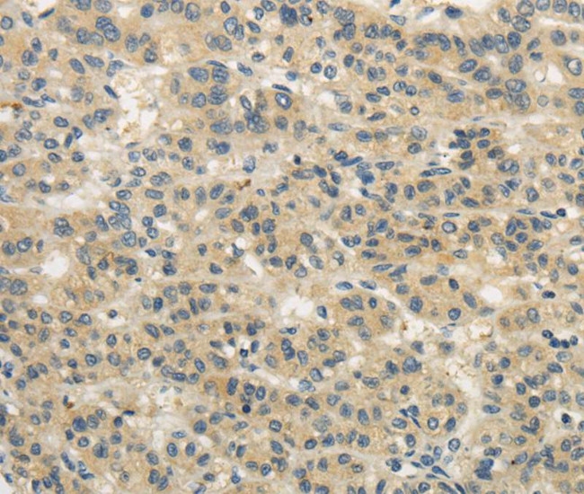 WDR91 Antibody in Immunohistochemistry (Paraffin) (IHC (P))