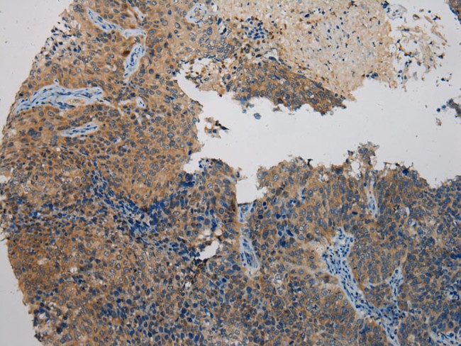 WDR45B Antibody in Immunohistochemistry (Paraffin) (IHC (P))