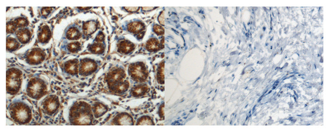 RASAL2 Antibody in Immunohistochemistry (Paraffin) (IHC (P))