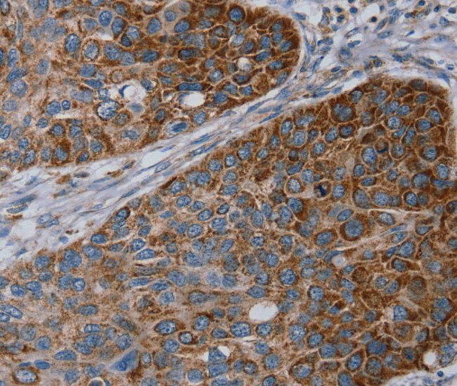 REG4 Antibody in Immunohistochemistry (Paraffin) (IHC (P))