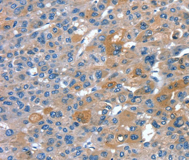 RNF7 Antibody in Immunohistochemistry (Paraffin) (IHC (P))