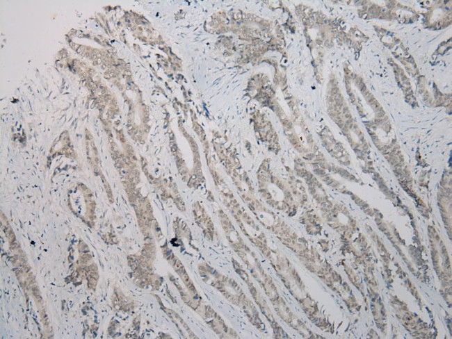 TBL1Y Antibody in Immunohistochemistry (Paraffin) (IHC (P))