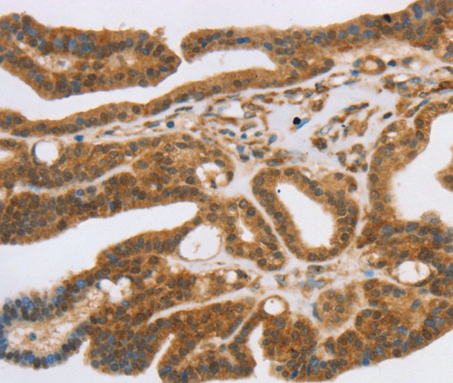 SLC7A9 Antibody in Immunohistochemistry (Paraffin) (IHC (P))