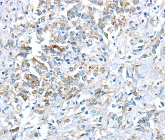 VWCE Antibody in Immunohistochemistry (Paraffin) (IHC (P))