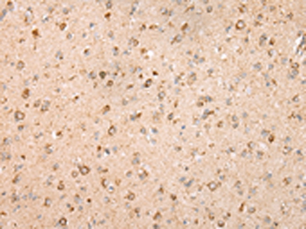 UQCRC2 Antibody in Immunohistochemistry (Paraffin) (IHC (P))