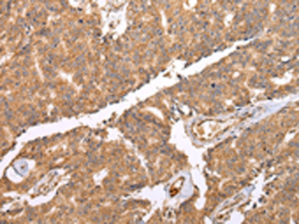 UQCRC2 Antibody in Immunohistochemistry (Paraffin) (IHC (P))