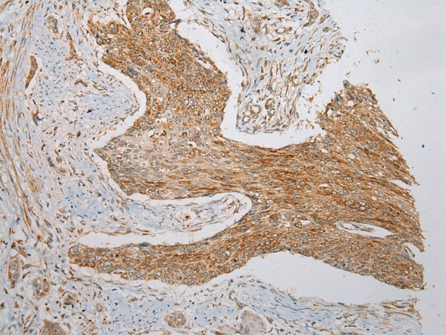 VDAC3 Antibody in Immunohistochemistry (Paraffin) (IHC (P))