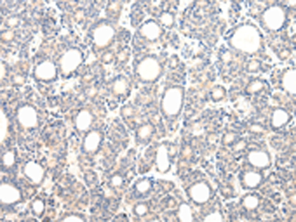VPS33B Antibody in Immunohistochemistry (Paraffin) (IHC (P))