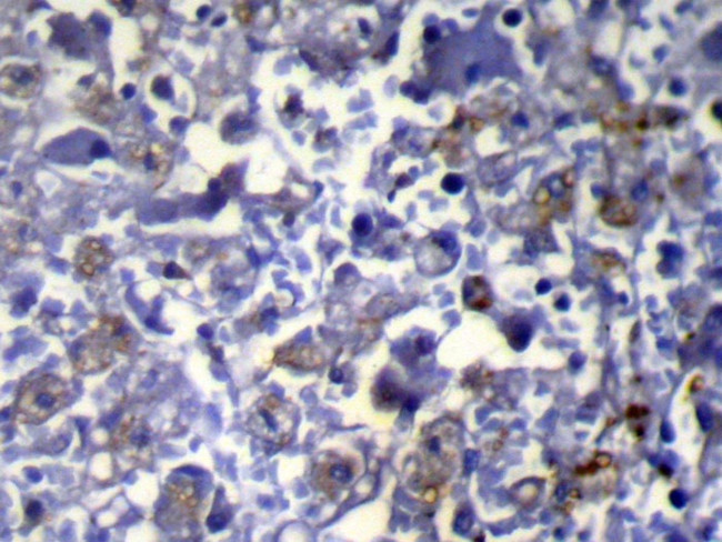 VPS37A Antibody in Immunohistochemistry (Paraffin) (IHC (P))