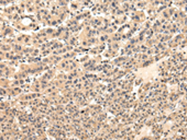 VPS37D Antibody in Immunohistochemistry (Paraffin) (IHC (P))